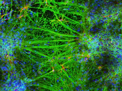 A Lab Just 3D-Printed a Neural Network of Living Brain Cells | WIRED