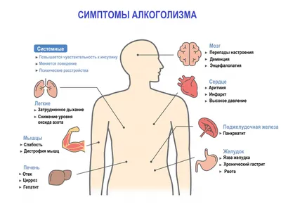 Алкоголизм Концептуальная Иллюстрация Алкоголизма — стоковая векторная  графика и другие изображения на тему Алкоголь - напиток - Алкоголь -  напиток, Безнадёжность, Бизнес - iStock