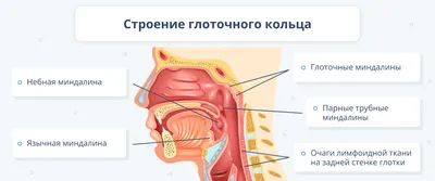 Ангина: симптомы, лечение и профилактика | Medstat | Дзен