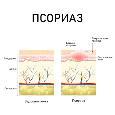 Практическая дерматология, Коллектив авторов – скачать pdf на ЛитРес