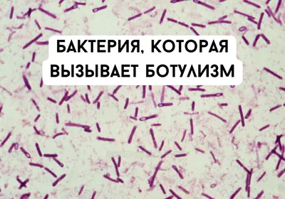 Haber7 (Турция): турецкие ученые открыли 60 новых видов бактерий в шести  странах (Haber7, Турция) | 07.10.2022, ИноСМИ