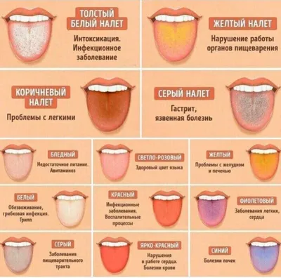 анатомия человеческого носа и языка, картинка глотки фон картинки и Фото  для бесплатной загрузки