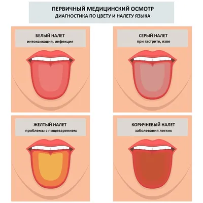 Скарлатина: симптомы, диагностика и лечение | ЛДЦ Здоровье