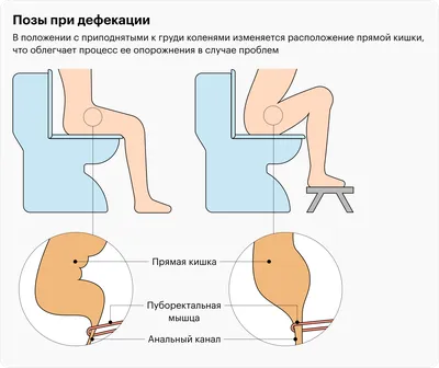 Что будет если долго сидеть в туалете | Вокруг Света