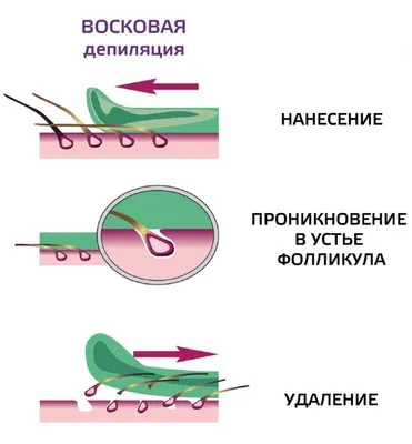 Депиляция воском - AntiStress