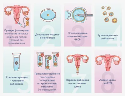 Эко-дерево infographic иллюстрация вектора. иллюстрации насчитывающей знак  - 46929677