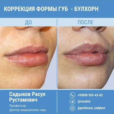 Губки-бантики👄😍 Плоские губы, ярко выраженный плоский бантик🎀 Форма губ  всегда обсуждается.. | ВКонтакте