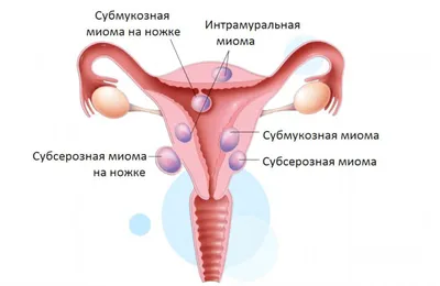 Акушерство и гинекология в Казани | Клиника «Скандинавия»