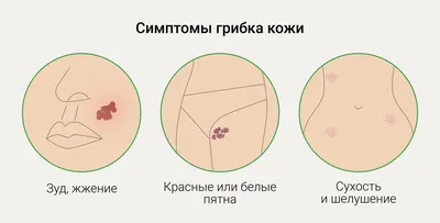 Грибок ногтей: симптомы, диагностика, лечение