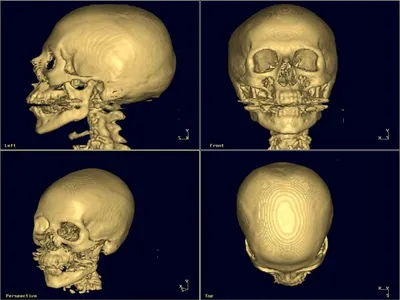 Бриллиантовые серьги черепа PRETTY SKULLS на заказ из белого и желтого  золота, серебра, платины или своего металла