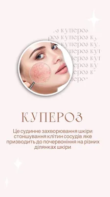 Идеи для сторис косметолог | Cosmetology, Creative instagram stories,  Cosmetics