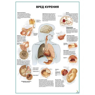 Плакаты о вреде курения купить в Москве, каталог и цены | Изготовление на  заказ