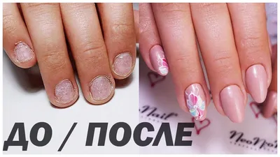 Акриловое наращивание ногтей в студии Nails - N.A.I.L.S. Russia - лучшая  сеть студий маникюра и педикюра в Москве