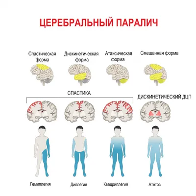 Ох уж эта психология: позы пар во время сна | Интернет-магазин матрасов  «Ефросиния»