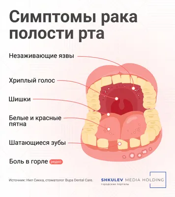 Рак языка — опухоль, которая редко встречается, но отличается  неблагоприятным течением и частым метастазированием. Симптомы  неспецифичны:… | Instagram