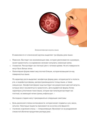 Туапсинская стоматологическая поликлинника | Медицинская профилактика