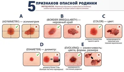 Blog | Что такое рак кожи? Каковы симптомы? Как это лечится?