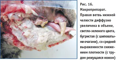 Рак полости рта: факторы риска и скрининг