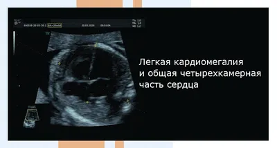 Беременность двойней: особенности протекания, что должна знать будущая мама