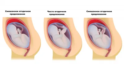 22 неделя беременности - все о беременности на 22 неделе - Телеграф