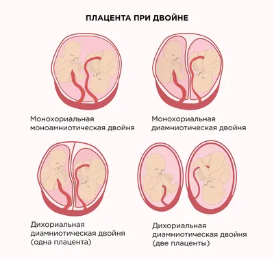 Перинатальный период — воспитание до рождения | ПульсПлюс | Дзен