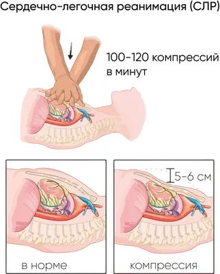 Анестезиология, реанимация и интенсивная терапия - СПб ГБУЗ \"ГМПБ №2\"