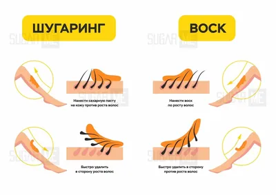 Что лучше: Шугаринг или восковая эпиляция? Наблюдения клиента салонов  эпиляции с многолетним стажем