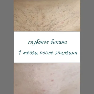 Шугаринг FRC Beauty (Soft) - Сахарная Мягкая паста для шугаринга  (ID#987341263), цена: 61.75 ₴, купить на Prom.ua