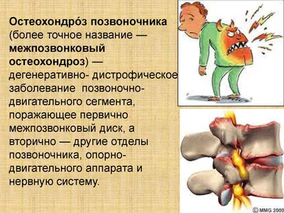 Упражнения при грыже поясничного отдела позвоночника