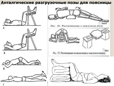 ЛФК и массаж при остеохондрозе - презентация онлайн