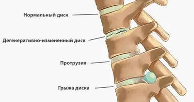 Упражнения при поясничном остеохондрозе - YouTube