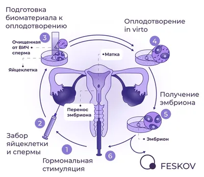 Как ВИЧ-инфекция стала мировой эпидемией