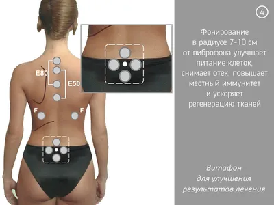 ВИТАФОН аппарат виброакустического воздействия Витафон-Т купить в Нижнем  Новгороде | Релакс