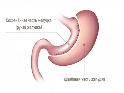 Бутерброд и желудок