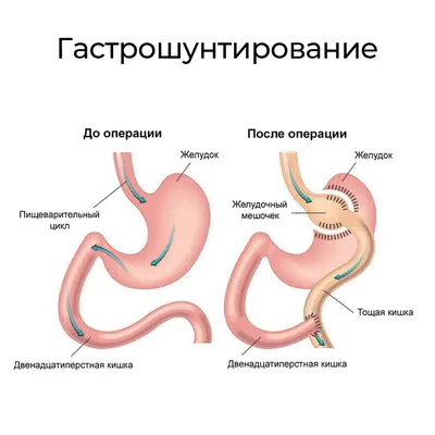 Болит желудок - диагностика и методы лечения