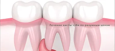 Натуральные Фото реставрации зубов до и после | Екатеринбург